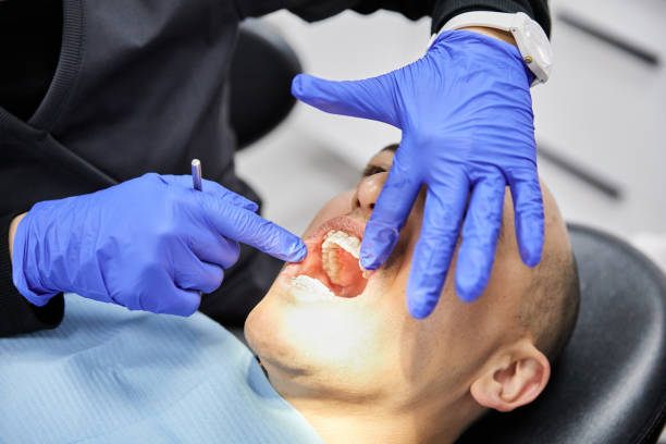 Best Emergency Broken Tooth Repair in Rosedale, MS